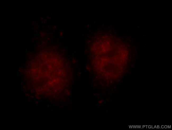 BMI1 Antibody in Immunocytochemistry (ICC/IF)