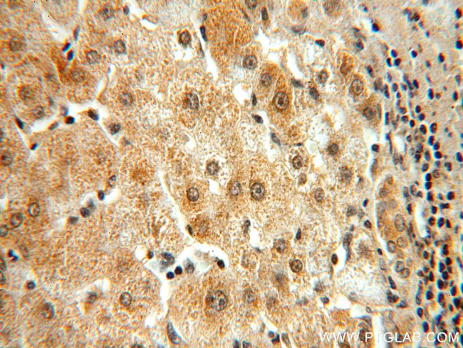 BMI1 Antibody in Immunohistochemistry (Paraffin) (IHC (P))