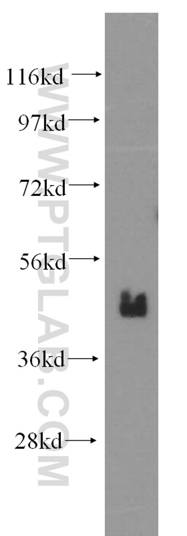 BMI1 Antibody in Western Blot (WB)
