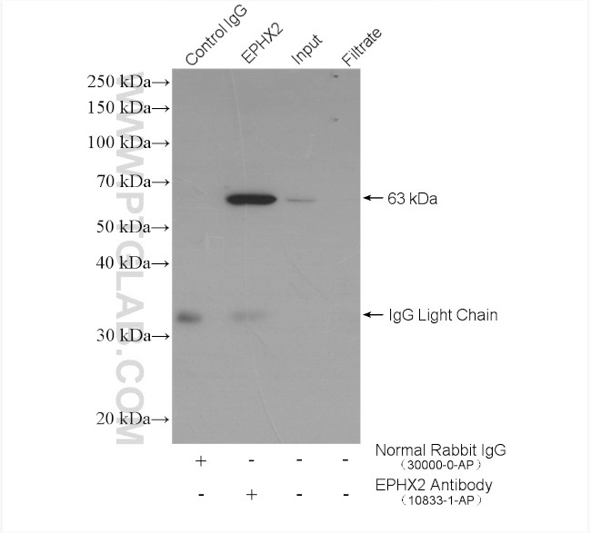 EPHX2 Antibody in Immunoprecipitation (IP)