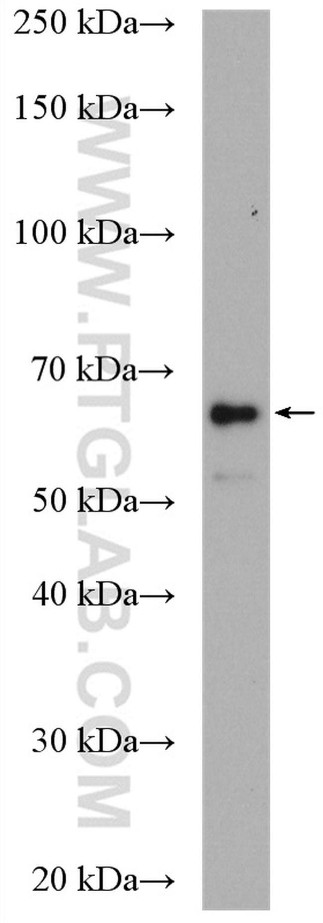 EPHX2 Antibody in Western Blot (WB)