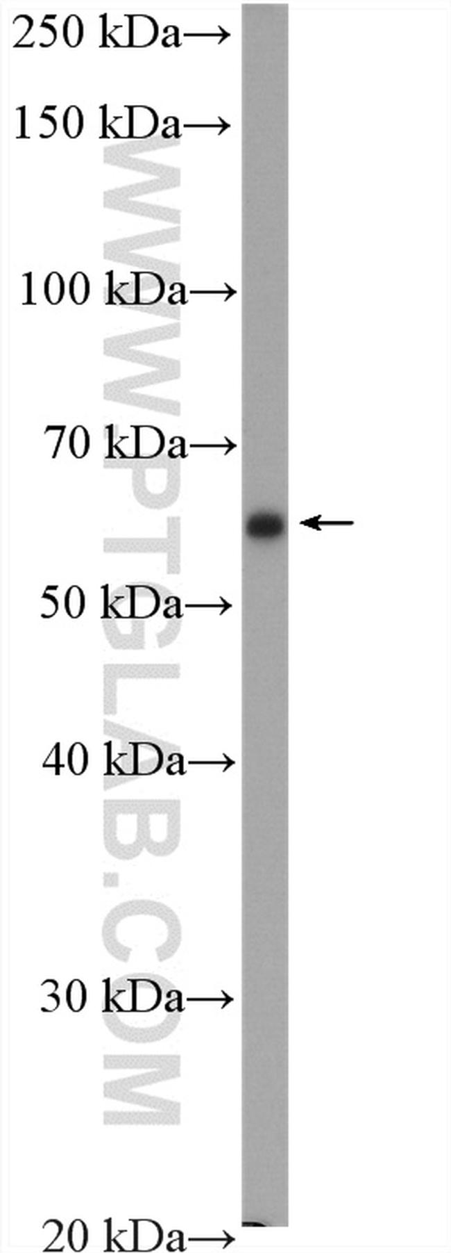 EPHX2 Antibody in Western Blot (WB)