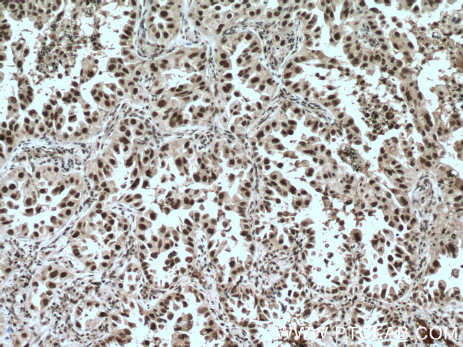 LSM4 Antibody in Immunohistochemistry (Paraffin) (IHC (P))