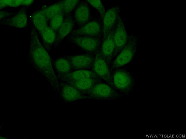 ATF4 Antibody in Immunocytochemistry (ICC/IF)