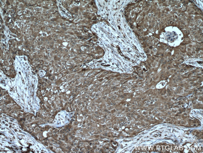 ATF4 Antibody in Immunohistochemistry (Paraffin) (IHC (P))