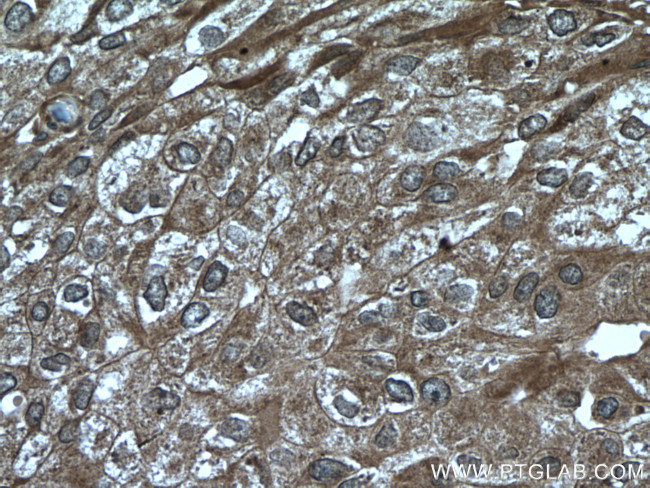 ATF4 Antibody in Immunohistochemistry (Paraffin) (IHC (P))