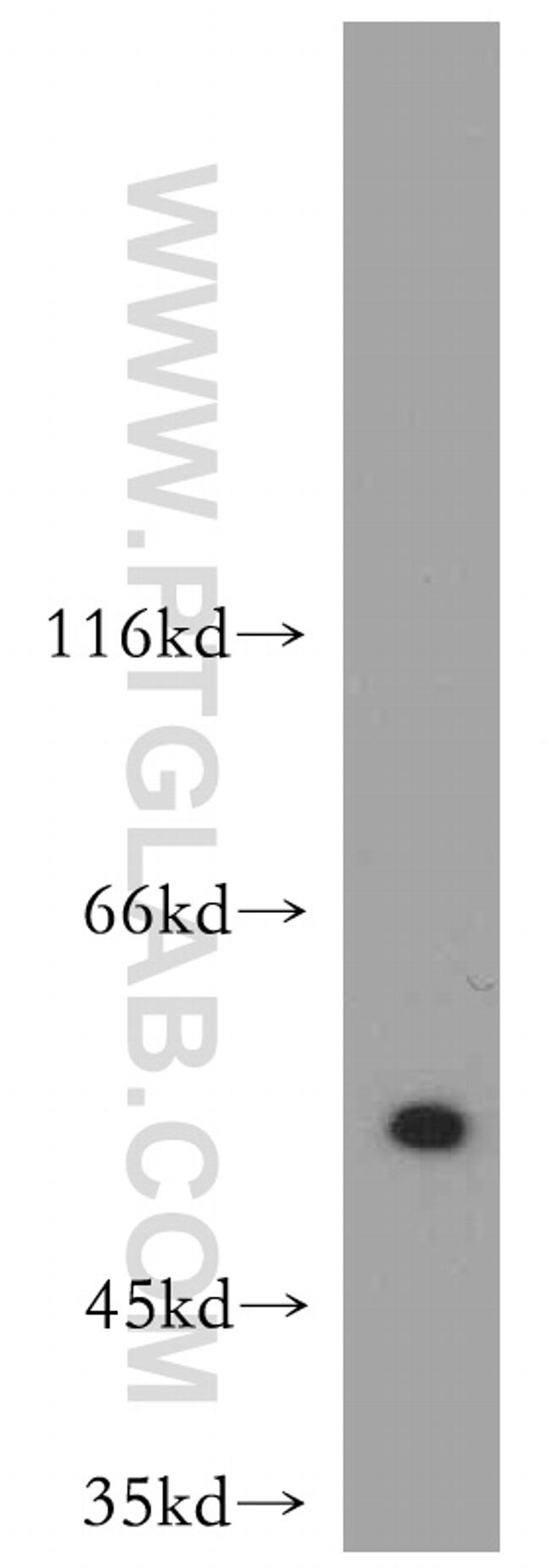 ATF4 Antibody in Western Blot (WB)