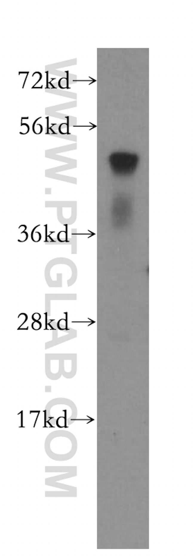 ATF4 Antibody in Western Blot (WB)