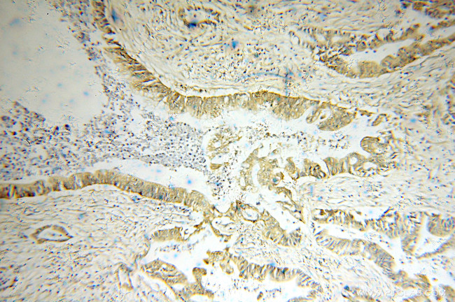 OPTN Antibody in Immunohistochemistry (Paraffin) (IHC (P))