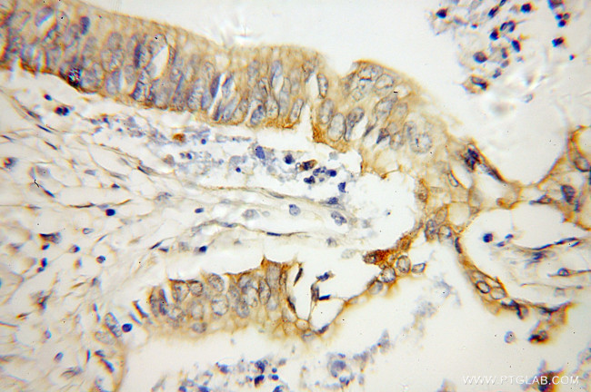 OPTN Antibody in Immunohistochemistry (Paraffin) (IHC (P))