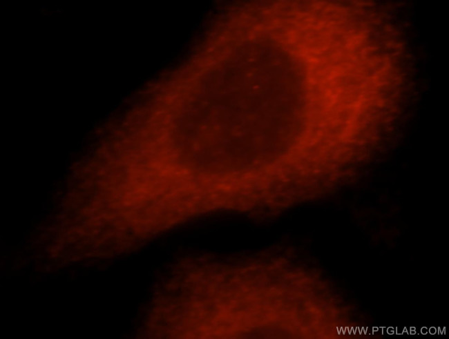 OPTN Antibody in Immunocytochemistry (ICC/IF)