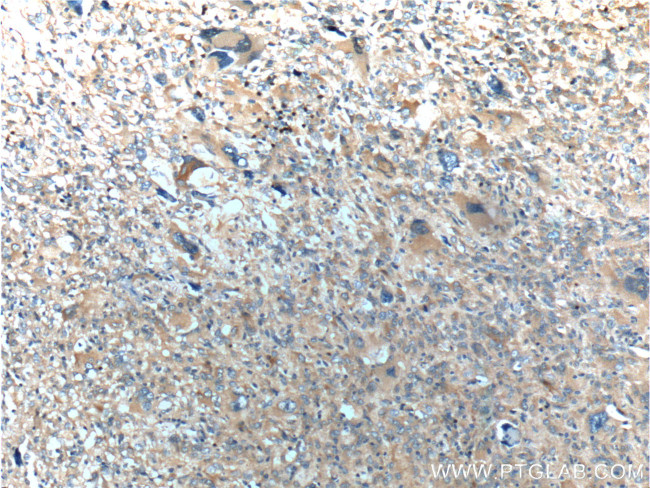 OPTN Antibody in Immunohistochemistry (Paraffin) (IHC (P))