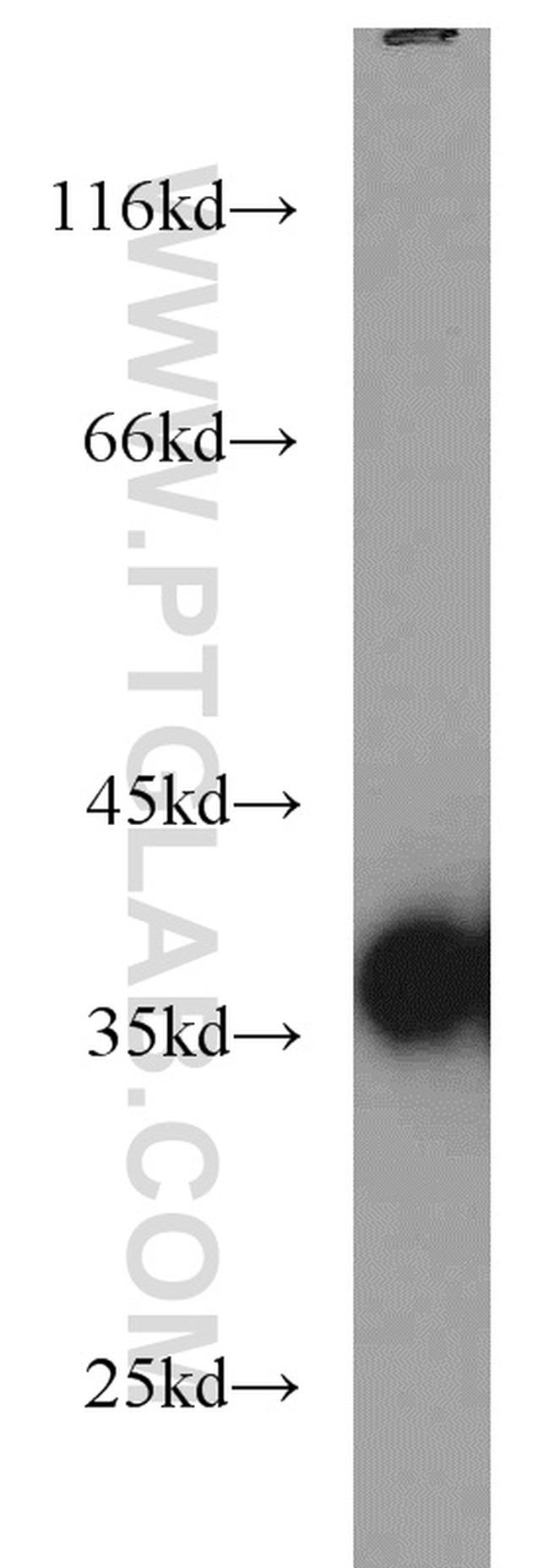 DNAJB2 Antibody in Western Blot (WB)