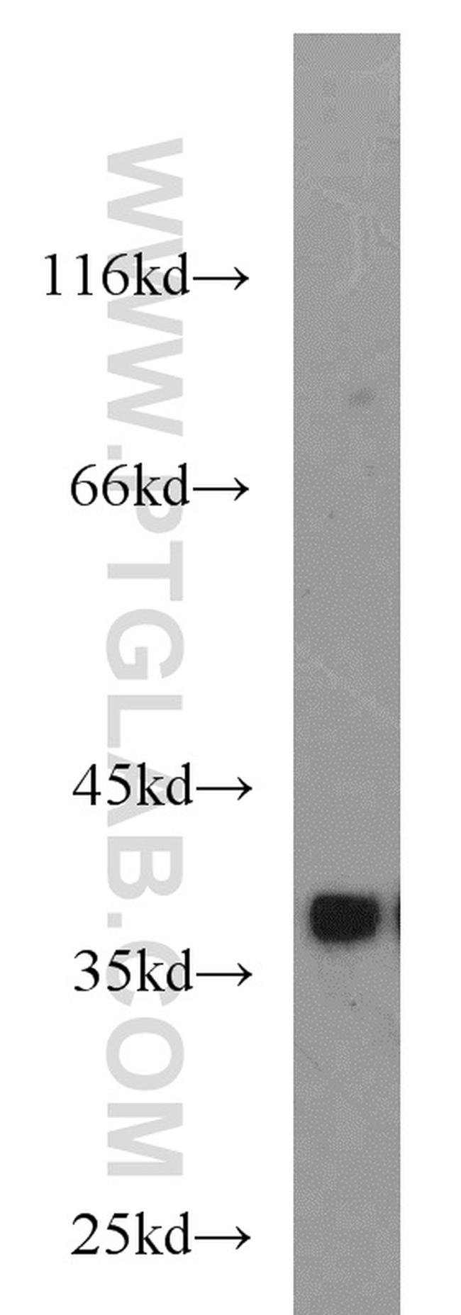 DNAJB2 Antibody in Western Blot (WB)