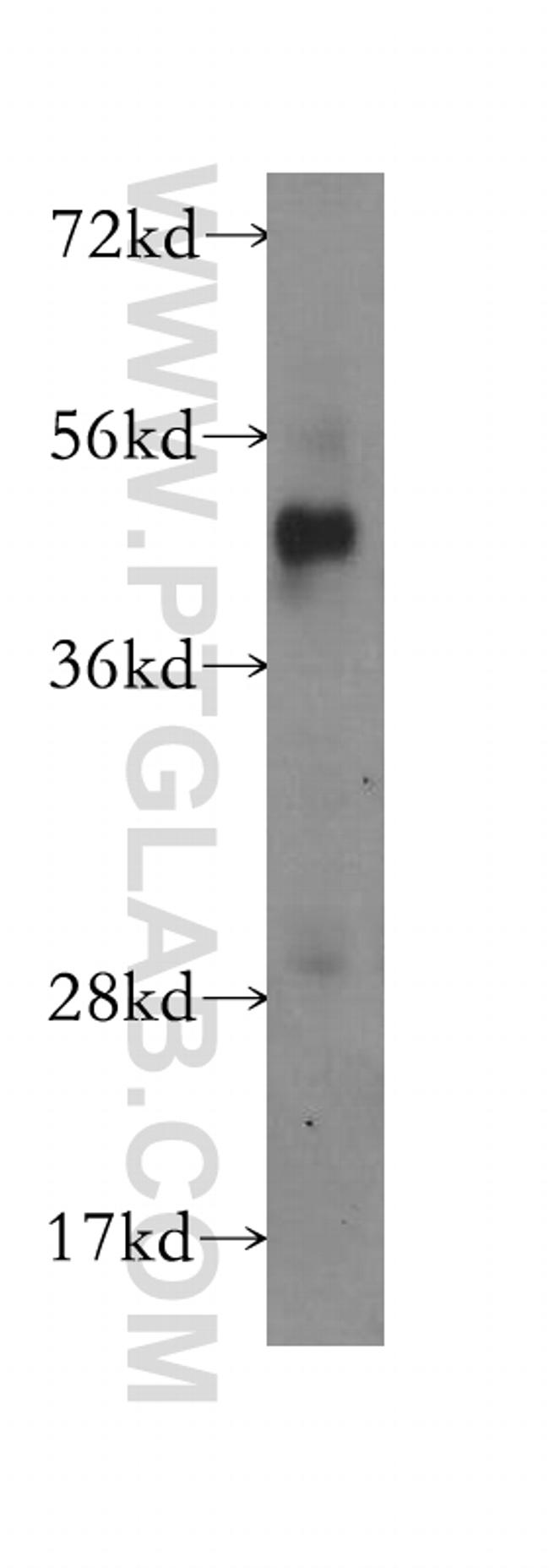 DNAJB2 Antibody in Western Blot (WB)