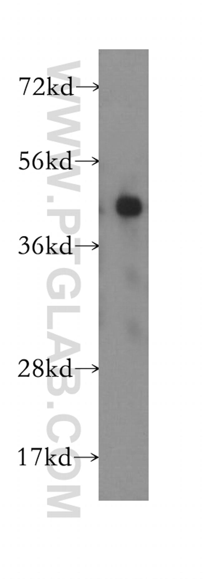 DNAJB2 Antibody in Western Blot (WB)