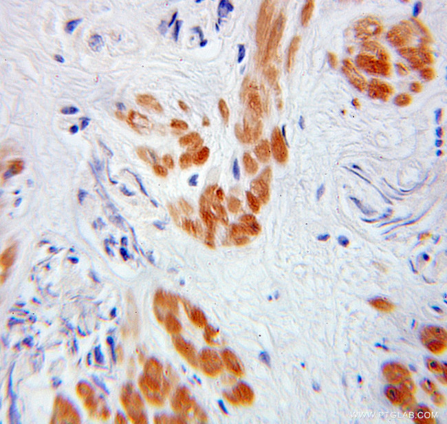 TADA3L Antibody in Immunohistochemistry (Paraffin) (IHC (P))