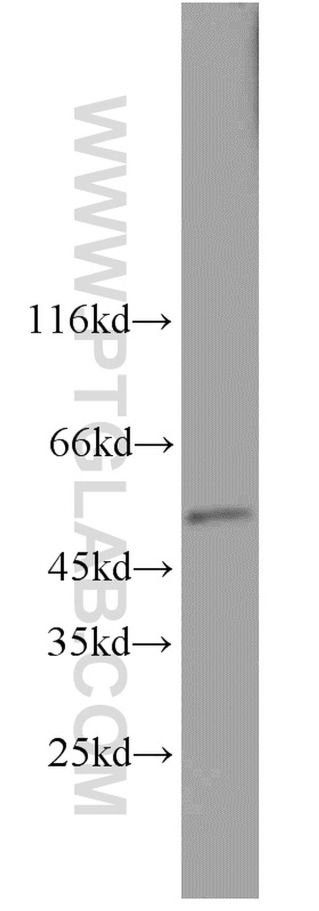 TADA3L Antibody in Western Blot (WB)