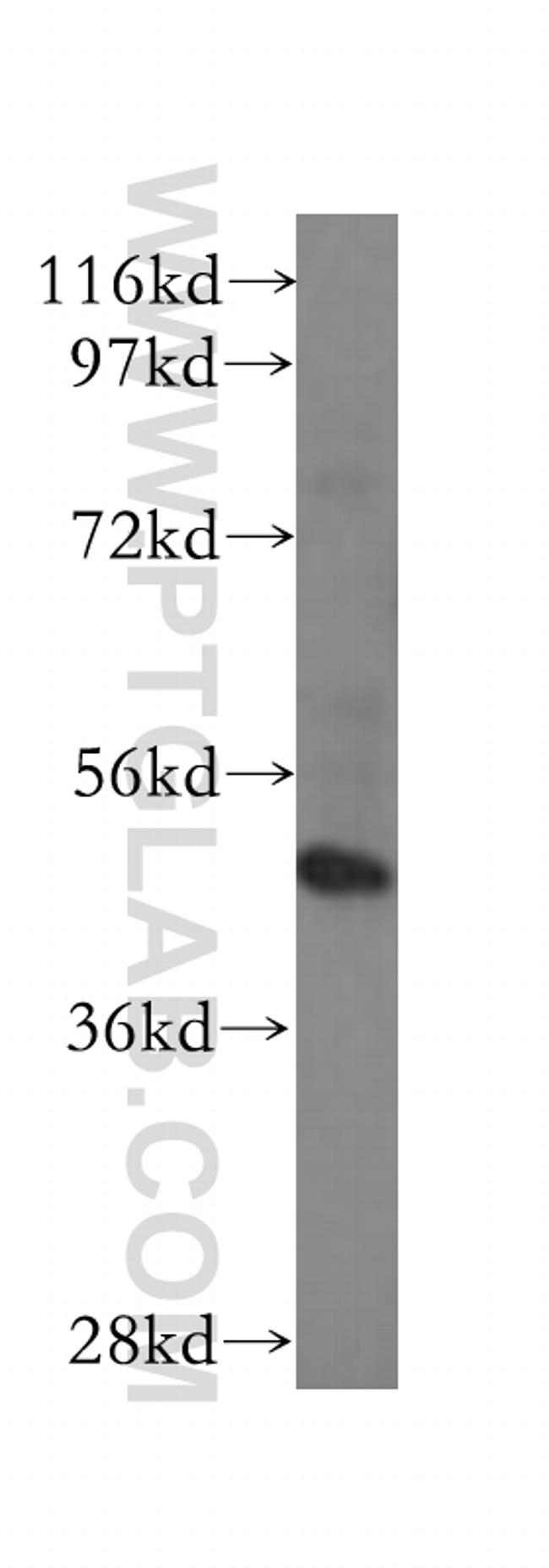 TADA3L Antibody in Western Blot (WB)