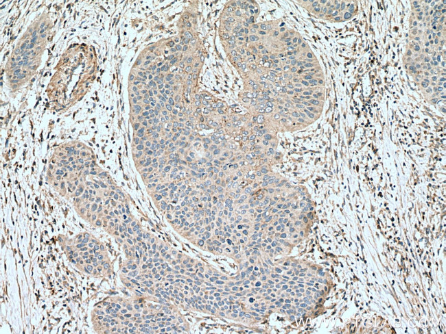 RAP1B Antibody in Immunohistochemistry (Paraffin) (IHC (P))