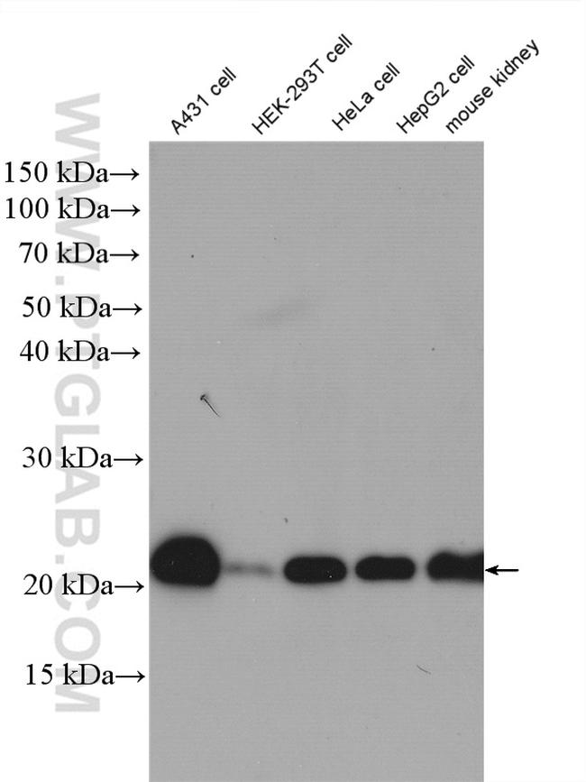 RAP1B Antibody in Western Blot (WB)