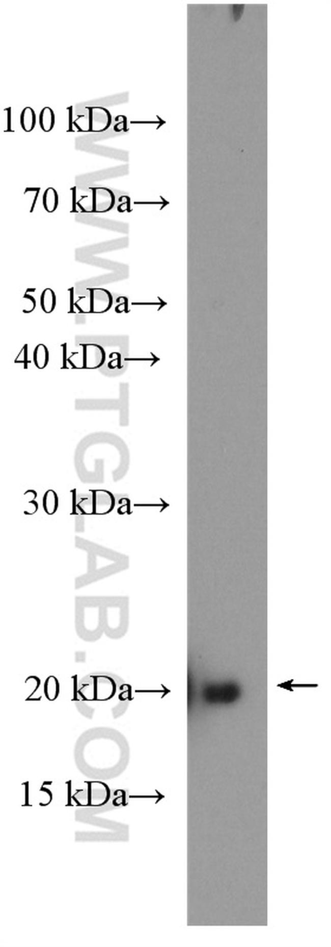 RAP1B Antibody in Western Blot (WB)