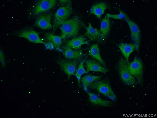 alpha-synuclein Antibody in Immunocytochemistry (ICC/IF)