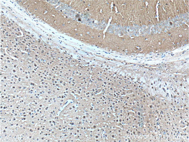 alpha-synuclein Antibody in Immunohistochemistry (Paraffin) (IHC (P))