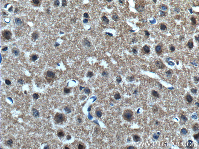 alpha-synuclein Antibody in Immunohistochemistry (Paraffin) (IHC (P))