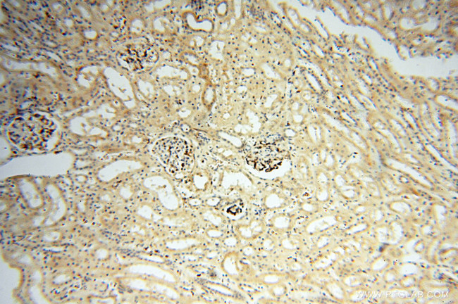 alpha-synuclein Antibody in Immunohistochemistry (Paraffin) (IHC (P))