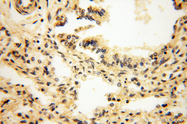 alpha-synuclein Antibody in Immunohistochemistry (Paraffin) (IHC (P))