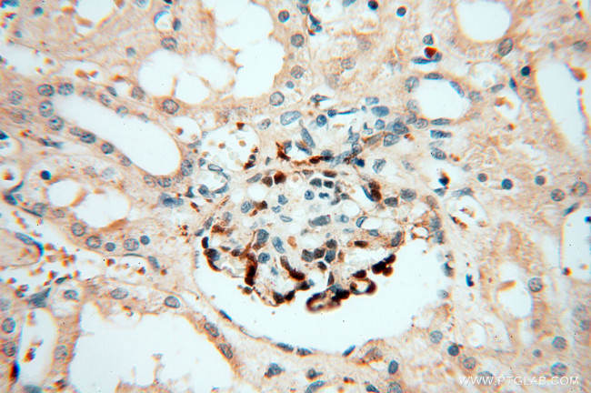 alpha-synuclein Antibody in Immunohistochemistry (Paraffin) (IHC (P))