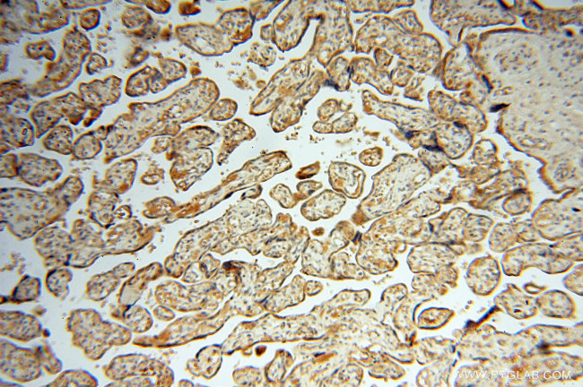 alpha-synuclein Antibody in Immunohistochemistry (Paraffin) (IHC (P))