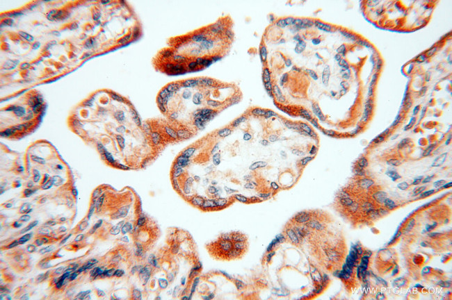 alpha-synuclein Antibody in Immunohistochemistry (Paraffin) (IHC (P))