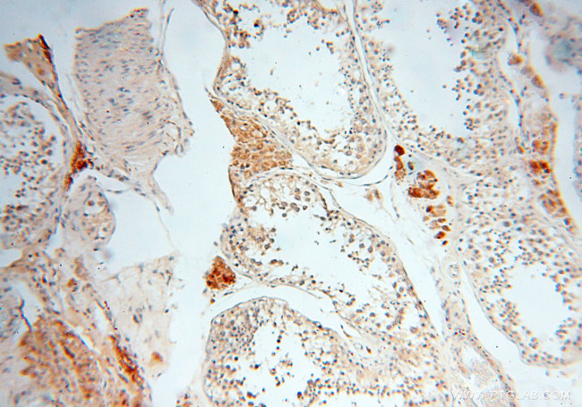 alpha-synuclein Antibody in Immunohistochemistry (Paraffin) (IHC (P))