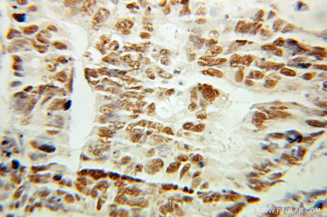 ANP32B Antibody in Immunohistochemistry (Paraffin) (IHC (P))