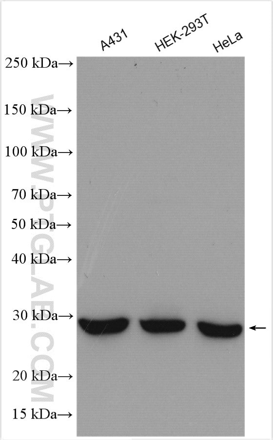 ANP32B Antibody in Western Blot (WB)