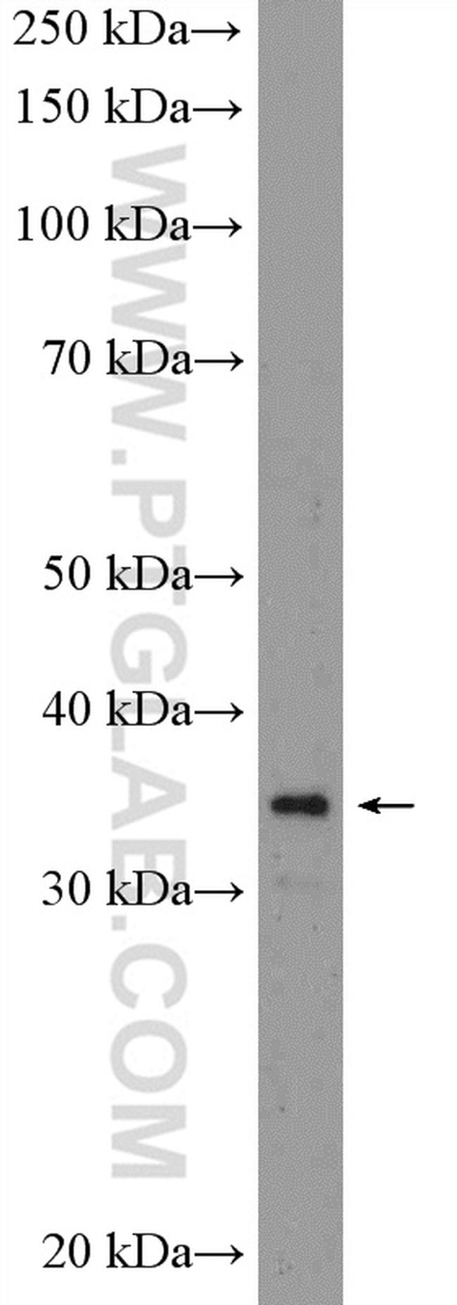 ANP32B Antibody in Western Blot (WB)