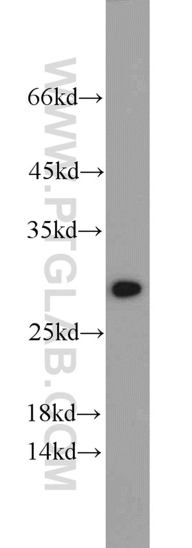 ANP32B Antibody in Western Blot (WB)