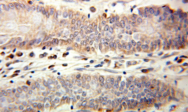 IL1RA Antibody in Immunohistochemistry (Paraffin) (IHC (P))