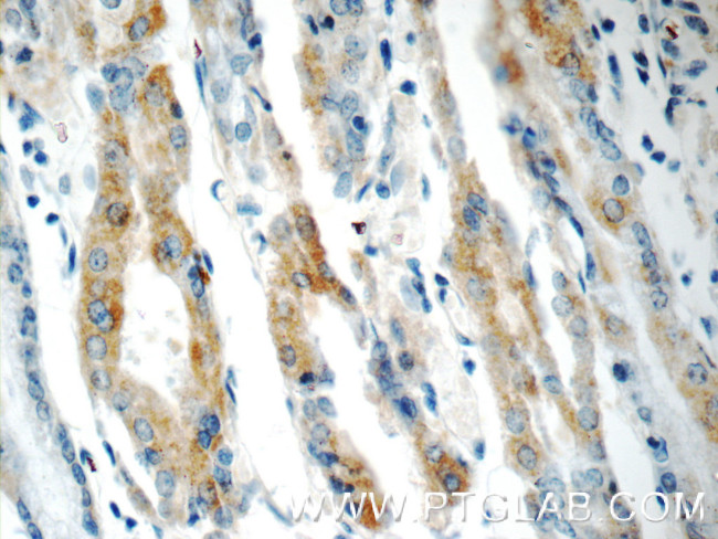 IL1RA Antibody in Immunohistochemistry (Paraffin) (IHC (P))