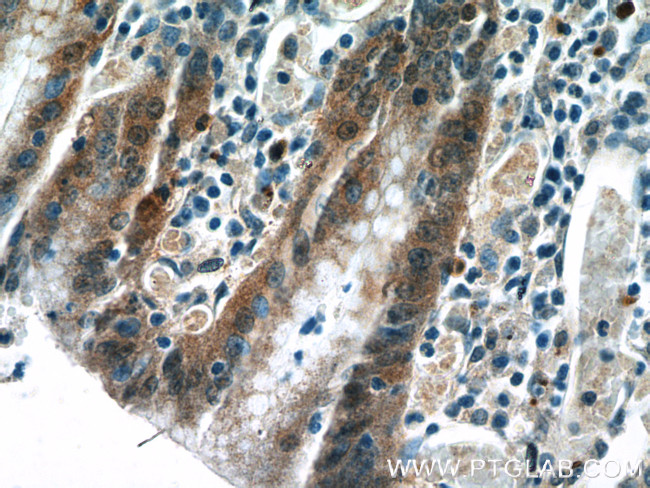 IL1RA Antibody in Immunohistochemistry (Paraffin) (IHC (P))