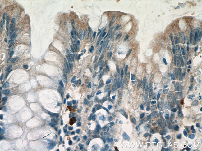 IL1RA Antibody in Immunohistochemistry (Paraffin) (IHC (P))