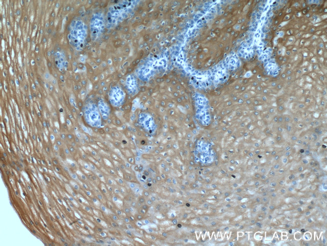 IL1RA Antibody in Immunohistochemistry (Paraffin) (IHC (P))