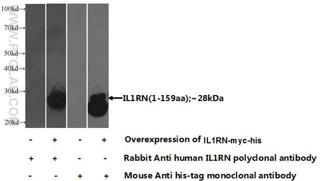 IL1RA Antibody in Western Blot (WB)