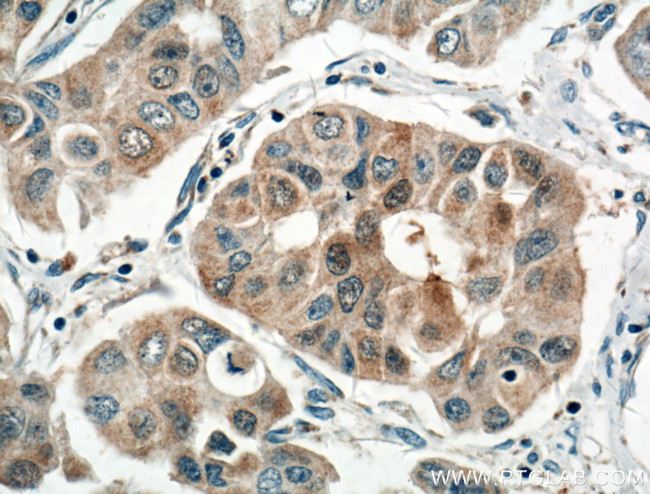 NOL3 Antibody in Immunohistochemistry (Paraffin) (IHC (P))