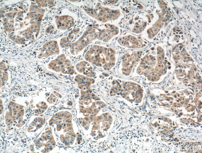 NOL3 Antibody in Immunohistochemistry (Paraffin) (IHC (P))