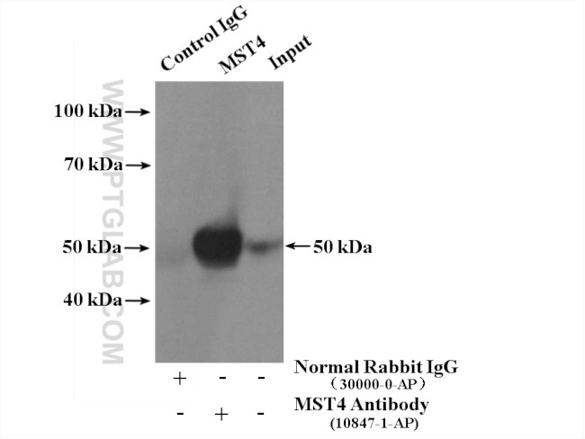 MST4 Antibody in Immunoprecipitation (IP)