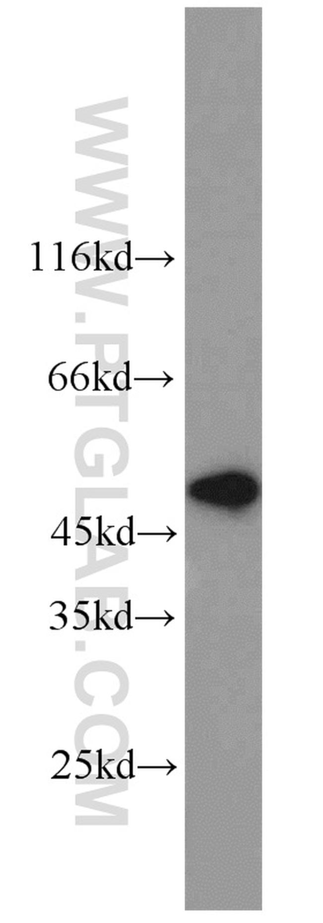 MST4 Antibody in Western Blot (WB)