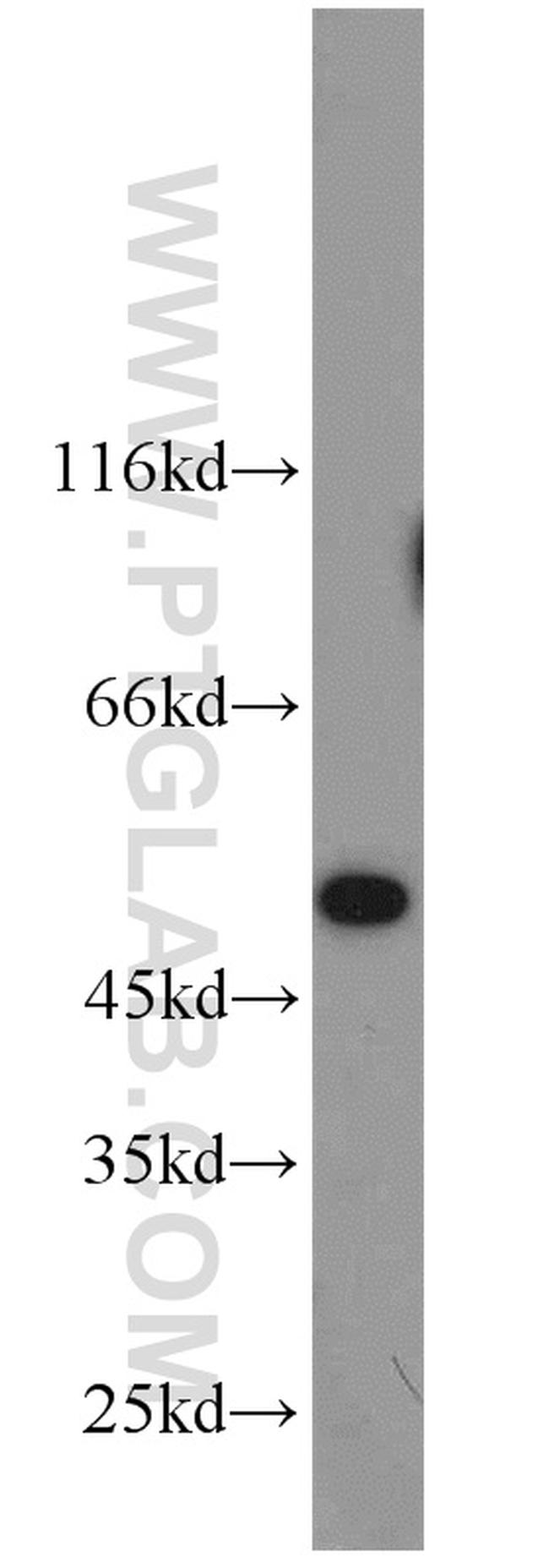 MST4 Antibody in Western Blot (WB)